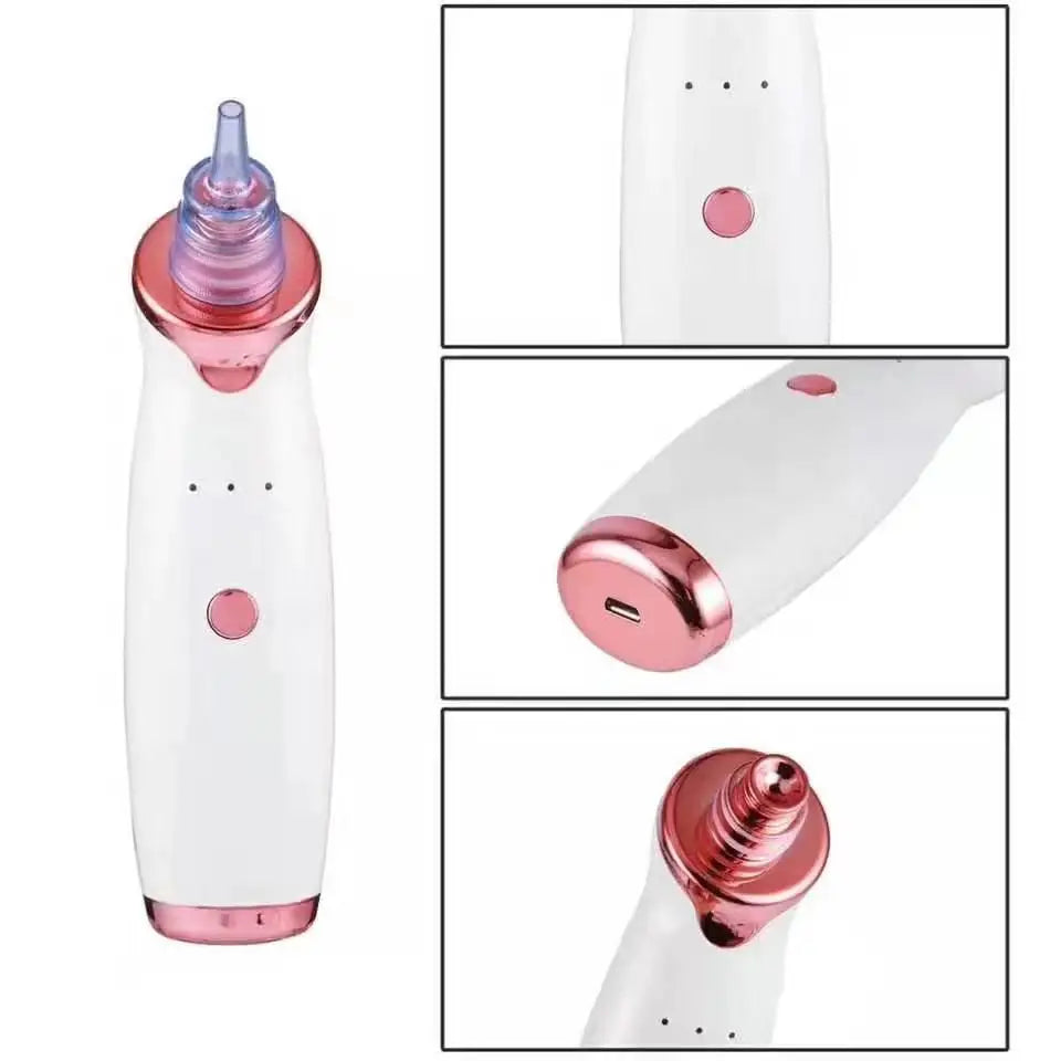 Buy Pore Vacuum Blackhead Remover