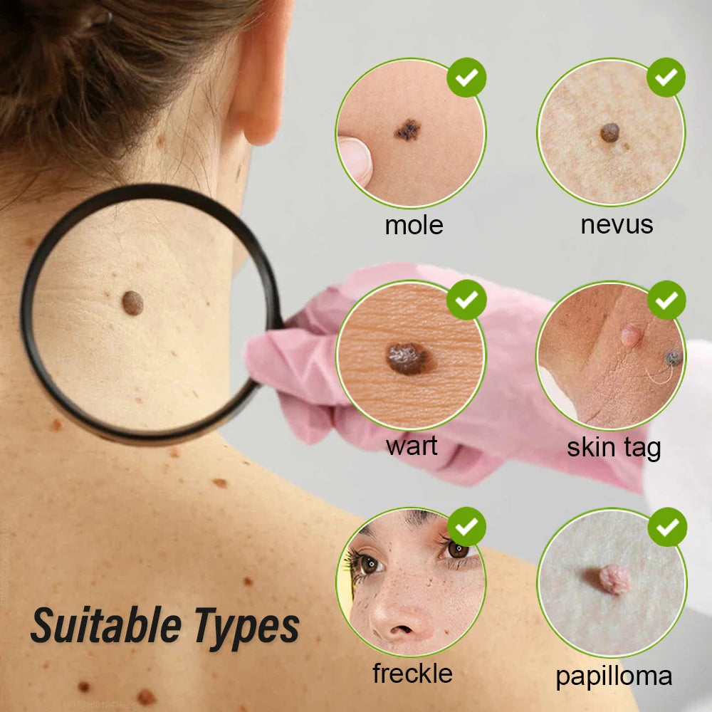 Spot removal process