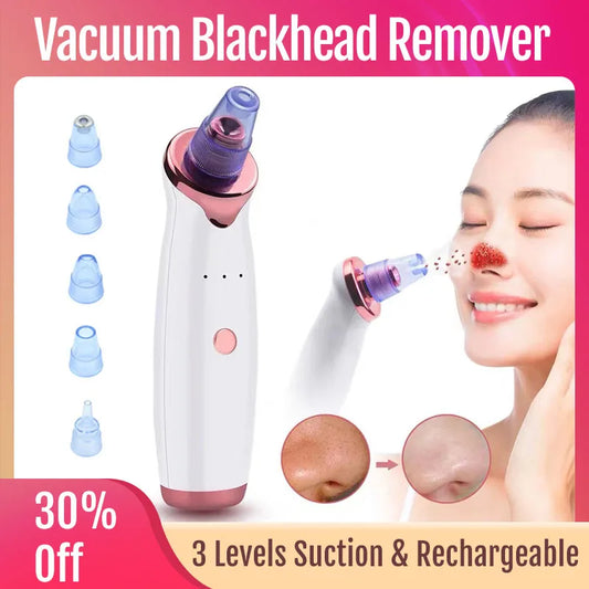 Pore Vacuum Blackhead Remover - AGTC